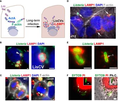 The Viable But Non-Culturable State of Listeria monocytogenes in the One-Health Continuum